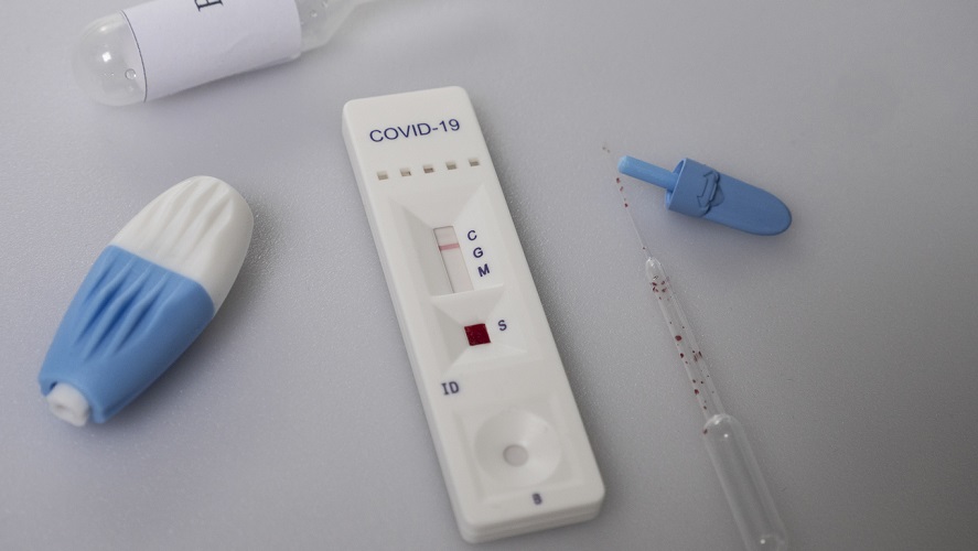 Entenda as regras para testes rápidos de Covid-19 em farmácias